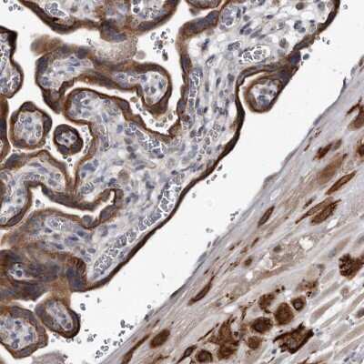 Immunohistochemistry-Paraffin YPEL3 Antibody