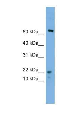 Western Blot: YPEL5 Antibody [NBP1-79644] - Hela cell lysate, concentration 0.2-1 ug/ml.