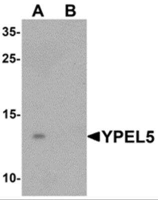 Western Blot YPEL5 Antibody - BSA Free