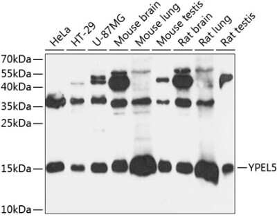 Western Blot: YPEL5 Antibody [NBP2-93289] - Analysis of extracts of various cell lines, using YPEL5 at 1:3000 dilution. Secondary antibody: HRP Goat Anti-Rabbit IgG (H+L) at 1:10000 dilution. Lysates/proteins: 25ug per lane. Blocking buffer: 3% nonfat dry milk in TBST. Detection: ECL Basic Kit . Exposure time: 90s.