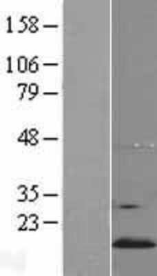 Western Blot: YPEL5 Overexpression Lysate (Adult Normal) [NBP2-09444] Left-Empty vector transfected control cell lysate (HEK293 cell lysate); Right -Over-expression Lysate for YPEL5.