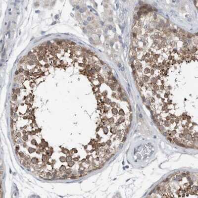Immunohistochemistry-Paraffin: YRDC Antibody [NBP1-82072] - Staining of human testis shows moderate cytoplasmic positivity in cells in seminiferous ducts.