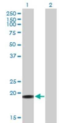 Western Blot: YSK4 Antibody [H00080122-B01P] - Analysis of YSK4 expression in transfected 293T cell line by YSK4 polyclonal antibody.  Lane 1: YSK4 transfected lysate(18.48 KDa). Lane 2: Non-transfected lysate.