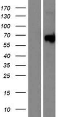 Western Blot: YSK4 Overexpression Lysate (Adult Normal) [NBP2-08673] Left-Empty vector transfected control cell lysate (HEK293 cell lysate); Right -Over-expression Lysate for YSK4.