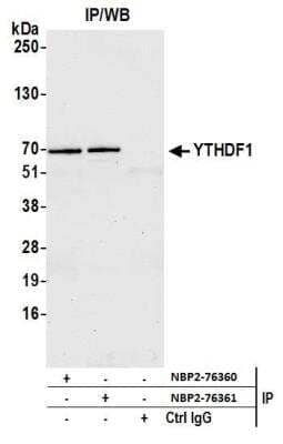 Immunoprecipitation: YTHD1 Antibody [NBP2-76360] - Samples: Whole cell lysate (1.0 mg per IP reaction; 20% of IP loaded) from GaMG cells prepared using NETN lysis buffer. Antibodies: Affinity purified rabbit anti-YTHDF1 antibody NBP2-76360 used for IP at 15 ul per reaction. YTHDF1 was also immunoprecipitated by rabbit anti-YTHDF1 NBP2-76361. For blotting immunoprecipitated YTHDF1 was used at 1:1000. Detection: Chemiluminescence with an exposure time of 30 seconds.