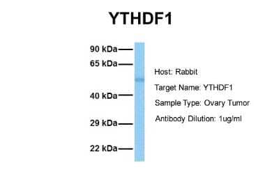 Western Blot: YTHD1 Antibody [NBP1-52865] - Sample Tissue: Human Ovary Tumor Antibody Dilution: 1.0 ug/ml