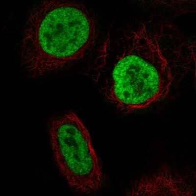 Immunocytochemistry/Immunofluorescence: YTHDC2 Antibody [NBP2-57606] - Staining of human cell line U-2 OS shows localization to nucleoplasm. Antibody staining is shown in green.