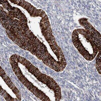 Immunohistochemistry-Paraffin: YTHDC2 Antibody [NBP1-85089] - Staining of human corpus, uterine shows strong cytoplasmic positivity in glandular cells.