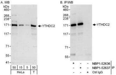 Western Blot: YTHDC2 Antibody [NBP1-52636] - Affinity purified rabbit anti-YTHDC2 antibody used for WB at 0.04 mcg/ml (A) and 0.4 mcg/ml (B) and used for IP at 6 mcg/mg lysate.  YTHDC2 was also immunoprecipitated by rabbit anti-YTHDC2 antibody NBP1-52637, which recognizes a downstream epitope.