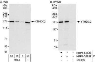 Western Blot: YTHDC2 Antibody [NBP1-52637] - Western Blot: YTHDC2 Antibody [NBP1-52637] - Affinity purified rabbit anti-YTHDC2 antibody NBP1-52637 used for WB at 0.04 mcg/ml (A) and 0.4 mcg/ml (B) and used for IP at 6 mcg/mg lysate.  YTHDC2 was also immunoprecipitated by rabbit anti-YTHDC2 antibody NBP1-52636, which recognizes an upstream epitope.