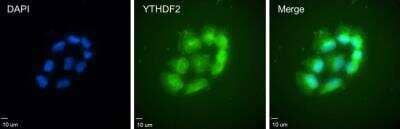 Immunocytochemistry/Immunofluorescence: YTHDF2 Antibody [H00051441-B01P] - YTHDF2 antibody was used (1:50) for labeling and microscopy analysis of the distribution of YTHDF2 proteins in SUM159 cells. Image from verified customer review.