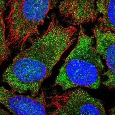 Immunocytochemistry/Immunofluorescence: YTHDF2 Antibody [NBP2-58340] - Staining of human cell line HeLa shows localization to cytosol. Antibody staining is shown in green.