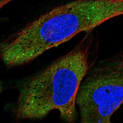 Immunocytochemistry/Immunofluorescence: YTHDF2 Antibody [NBP2-68614] - Staining of human cell line U-2 OS shows localization to cytosol & cytoplasmic bodies.