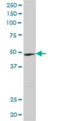 Western Blot: YTHDF2 Antibody [H00051441-B01P] - Analysis of YTHDF2 expression in human liver.