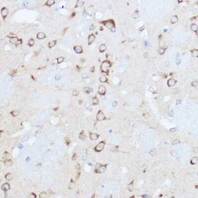 Immunohistochemistry-Paraffin YTHDF3 Antibody - BSA Free