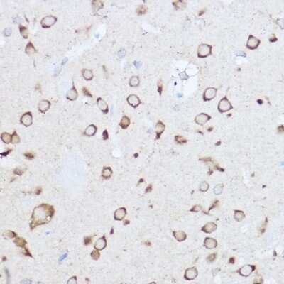 Immunohistochemistry-Paraffin YTHDF3 Antibody - BSA Free