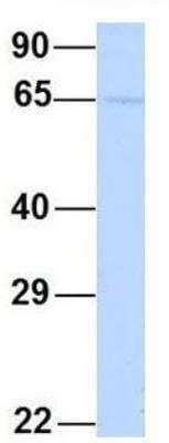 Western Blot: YTHDF3 Antibody [NBP1-56303] - Human 721_B.