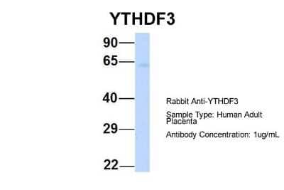 Western Blot: YTHDF3 Antibody [NBP1-56394] - Human Adult Placenta, Antibody Dilution: 1.0 ug/ml.