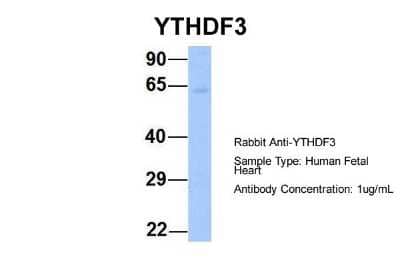 Western Blot: YTHDF3 Antibody [NBP1-56394] - Human Fetal Heart, Antibody Dilution: 1.0 ug/ml.