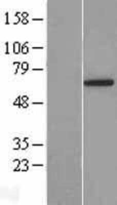 Western Blot: YTHDF3 Overexpression Lysate (Adult Normal) [NBL1-17945] Left-Empty vector transfected control cell lysate (HEK293 cell lysate); Right -Over-expression Lysate for YTHDF3.