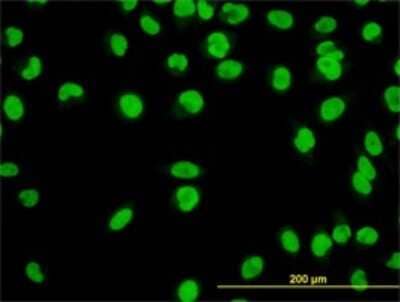 Immunocytochemistry/Immunofluorescence: YY1 Antibody (2C4) [H00007528-M01] - Analysis of monoclonal antibody to YY1 on HeLa cell. Antibody concentration 10 ug/ml.