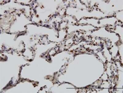 Immunohistochemistry-Paraffin: YY1 Antibody (2C4) [H00007528-M01] - Analysis of monoclonal antibody to YY1 on formalin-fixed paraffin-embedded human lung. Antibody concentration 3 ug/ml.