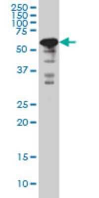 Western Blot: YY1 Antibody (2C5) [H00007528-M04] - Analysis of YY1 expression in Hela S3 NE (Cat # L013V3).