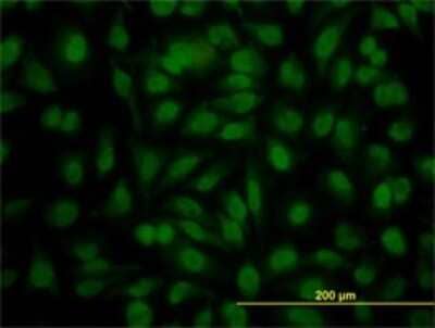 Immunocytochemistry/Immunofluorescence: YY1 Antibody (4A5) [H00007528-M02] - Analysis of monoclonal antibody to YY1 on HeLa cell. Antibody concentration 10 ug/ml.