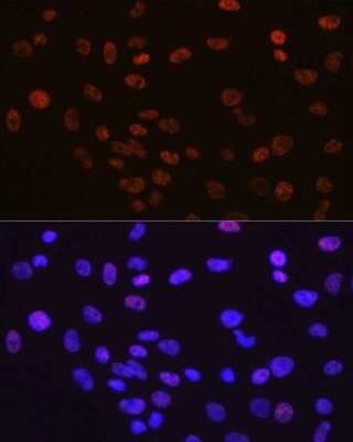 Immunocytochemistry/Immunofluorescence: YY1 Antibody (6J6L1) [NBP3-15779] - Immunofluorescence analysis of C6 cells using YY1 antibody (NBP3-15779). Blue: DAPI for nuclear staining.