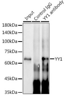 Immunoprecipitation: YY1 Antibody (6J6L1) [NBP3-15779] - Immunoprecipitation analysis of 300ug extracts of HeLa cells using 3ug YY1 antibody (NBP3-15779). Western blot was performed from the immunoprecipitate using YY1 antibody (NBP3-15779) at a dilition of 1:2000.