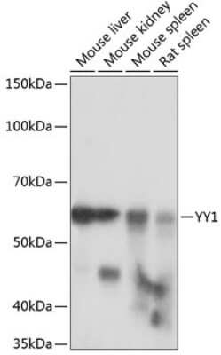 Western Blot: YY1 Antibody (6J6L1) [NBP3-15779] - Western blot analysis of extracts of various cell lines, using YY1 antibody (NBP3-15779) at 1:1000 dilution. Secondary antibody: HRP Goat Anti-Rabbit IgG (H+L) at 1:10000 dilution. Lysates/proteins: 25ug per lane. Blocking buffer: 3% nonfat dry milk in TBST. Detection: ECL Basic Kit. Exposure time: 10s.