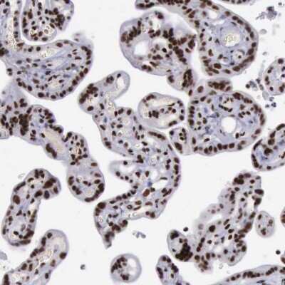 Immunohistochemistry-Paraffin: YY1 Antibody [NBP1-85260] - Staining of human placenta shows strong nuclear positivity in trophoblastic cells.