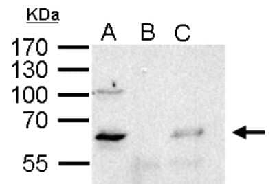 Immunoprecipitation: YY1 Antibody [NBP2-20933] - Sample: 1000 ug HeLa whole cell lysate/extract A. 50 ug HeLa whole cell lysate/extract B. Control with 2 ug of preimmune rabbit IgG C. Immunoprecipitation of YY1protein by 2 ug of YY1 antibody 10% SDS-PAGE The immunoprecipitated YY1 protein was detected by YY1 antibody diluted at 1:1000.  anti-rabbit IgG was used as a secondary reagent.