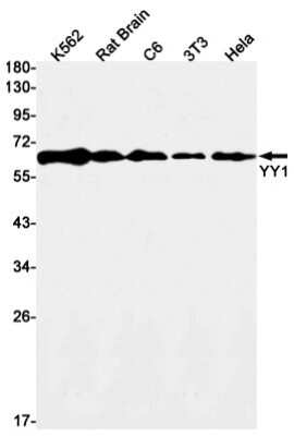 Western Blot: YY1 Antibody (S02-8A3) [NBP3-14987] - Western blot detection of YY1 in K562, Rat Brain, C6, 3T3, Hela cell lysates using YY1 Rabbit mAb (1:1000 diluted). Predicted band size: 45kDa. Observed band size: 65kDa.