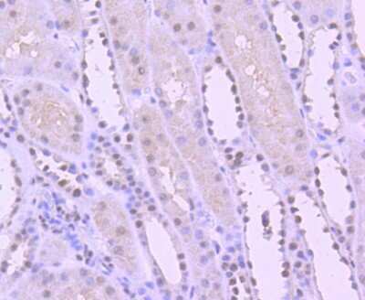 Immunohistochemistry-Paraffin: YY1 Antibody (SY29-01) [NBP2-67391] - Immunohistochemical analysis of paraffin-embedded human kidney tissue using anti-YY1 antibody. The section was pre-treated using heat mediated antigen retrieval with Tris-EDTA buffer (pH 8.0-8.4) for 20 minutes. The tissues were blocked in 5% BSA for 30 minutes at room temperature, washed with ddH2O and PBS, and then probed with the primary antibody (ET1605-40, 1/50) for 30 minutes at room temperature. The detection was performed using an HRP conjugated compact polymer system. DAB was used as the chromogen. Tissues were counterstained with hematoxylin and mounted with DPX.