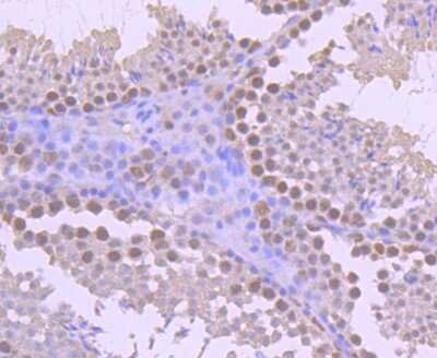 Immunohistochemistry-Paraffin: YY1 Antibody (SY29-01) [NBP2-67391] - Immunohistochemical analysis of paraffin-embedded mouse testis tissue using anti-YY1 antibody. The section was pre-treated using heat mediated antigen retrieval with Tris-EDTA buffer (pH 8.0-8.4) for 20 minutes. The tissues were blocked in 5% BSA for 30 minutes at room temperature, washed with ddH2O and PBS, and then probed with the primary antibody (ET1605-40, 1/50) for 30 minutes at room temperature. The detection was performed using an HRP conjugated compact polymer system. DAB was used as the chromogen. Tissues were counterstained with hematoxylin and mounted with DPX.