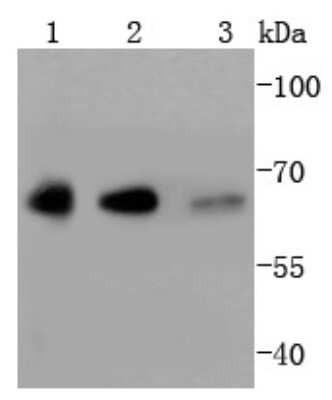 Western Blot: YY1 Antibody (SY29-01) [NBP2-67391] - Analysis of YY1 on different lysates using anti-YY1 antibody at 1/1,000 dilution. Positive control: Lane 1: Hela Lane 2: Jurkat Lane 3: HL-60