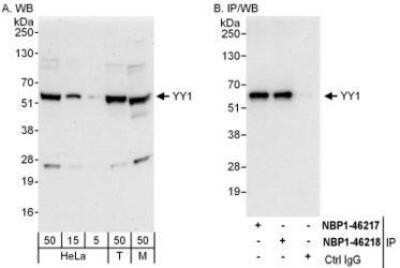 Western Blot YY1 Antibody