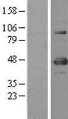 Western Blot: YY1 Overexpression Lysate (Adult Normal) [NBL1-17953] Left-Empty vector transfected control cell lysate (HEK293 cell lysate); Right -Over-expression Lysate for YY1.