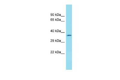 Western Blot: YdjC Homolog (Bacterial) Antibody [NBP2-83770] - Host: Rabbit. Target Name: YDJC. Sample Type: COLO205 Whole Cell lysates. Antibody Dilution: 1.0ug/ml