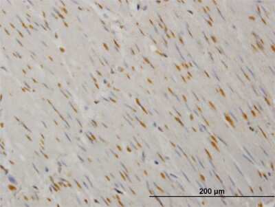 Immunohistochemistry-Paraffin: Yes Antibody (2D5) [H00007525-M03] - Analysis of monoclonal antibody to YES1 on formalin-fixed paraffin-embedded human smooth muscle. Antibody concentration 3 ug/ml