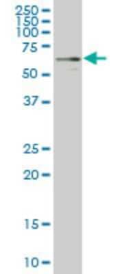 Western Blot: Yes Antibody (2D5) [H00007525-M03] - Analysis of YES1 expression in A-431 (Cat # L015V1).