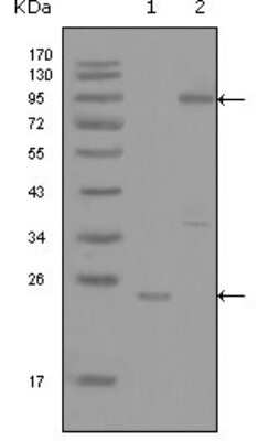 Western Blot: Yes Antibody (2F3E6) [NBP1-47520] - Analysis using YES1 mouse mAb against truncated YES1-His recombinant protein (1) and full-length GFP-YES1(aa1-543) transfected COS7 cell lysate (2).