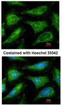 Immunocytochemistry/Immunofluorescence: Yes Antibody [NBP1-31297] -  Analysis of methanol-fixed HeLa, using antibody at 1:200 dilution.