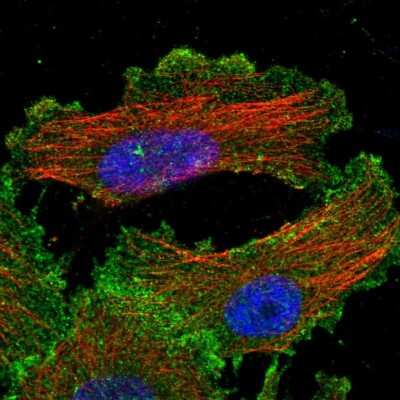 Immunocytochemistry/Immunofluorescence: Yes Antibody [NBP1-85369] - Immunofluorescent staining of human cell line U-251 MG shows localization to plasma membrane & cytosol.