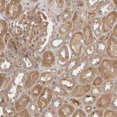 Immunohistochemistry-Paraffin: Yes Antibody [NBP1-85369] - Staining of human kidney shows moderate cytoplasmic positivity in tubule and glomerular cells.