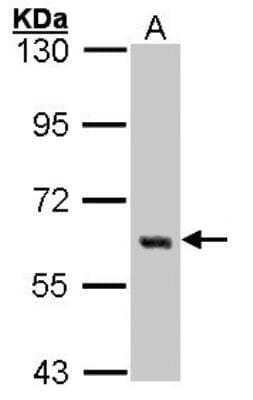 Western Blot: Yes Antibody [NBP1-31297] -  Sample (30 ug of whole cell lysate) A: A431 7.5% SDS PAGE; antibody diluted at 1:1000.