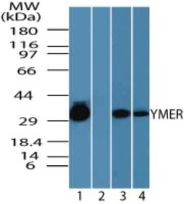 Western Blot: Ymer Antibody [NBP2-24483] - analysis of Chromosome 3 open reading frame 6 (YMER) in human skeletal muscle lysate in the 1) absence, 2) presence of immunizing peptide, 3) mouse skeletal muscle and 4) rat skeletal muscle lysate using this antibody. 05 ug/ml,0.25 ug/ml and 0.25 ug/ml respectively.