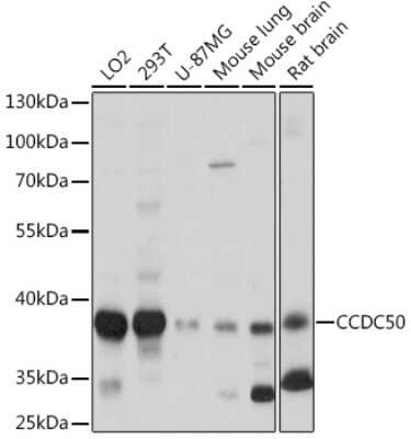 Western Blot: Ymer Antibody [NBP3-15552] - Western blot analysis of extracts of various cell lines, using Ymer Rabbit pAb (NBP3-15552) at 1:1000 dilution. Secondary antibody: HRP Goat Anti-Rabbit IgG (H+L) at 1:10000 dilution. Lysates/proteins: 25ug per lane. Blocking buffer: 3% nonfat dry milk in TBST. Detection: ECL Basic Kit. Exposure time: 1s.