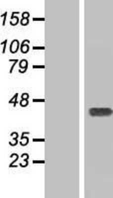 Western Blot: Ymer Overexpression Lysate (Adult Normal) [NBL1-08801] Left-Empty vector transfected control cell lysate (HEK293 cell lysate); Right -Over-expression Lysate for Ymer.